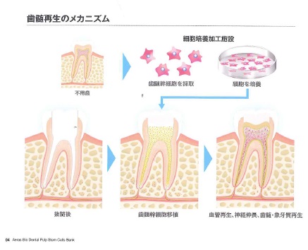 乳歯は冷凍保存する時代 歯髄幹細胞バンクとは